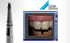 The missing link between Dürr's USB based digital VistaCam intraoral cameras and SIDEXIS XG